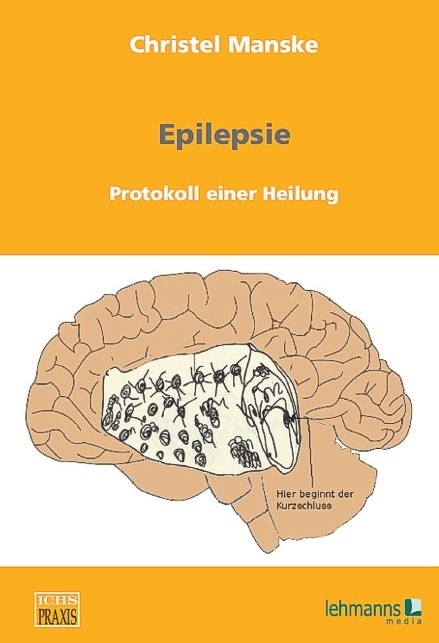 Epilepsie. Protokoll einer Heilung | Christel Manske Institut
